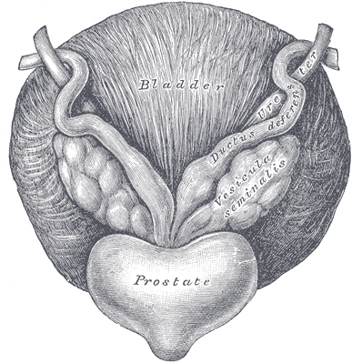 litho bladder